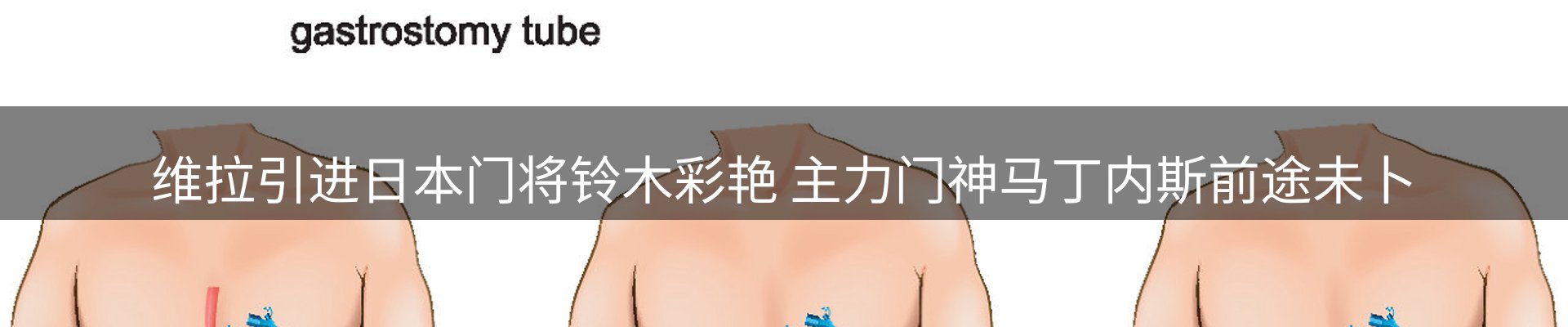热点视点